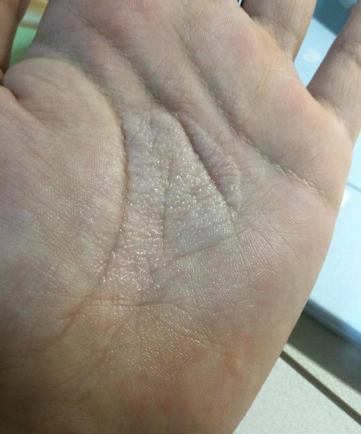 难道我买人家过期的,我是把水乳挤在手上然后涂的脸,大概五分钟有水乳