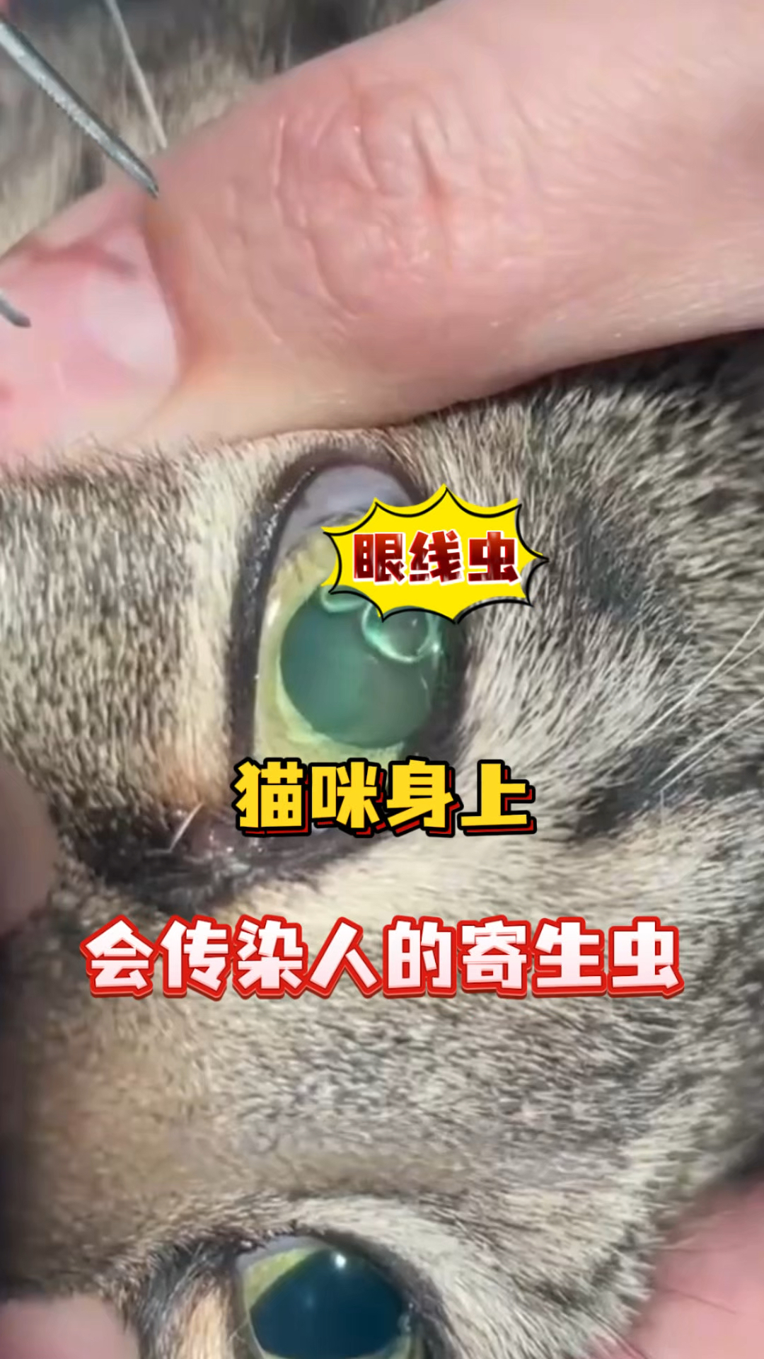 猫寄生虫会传染给人吗图片