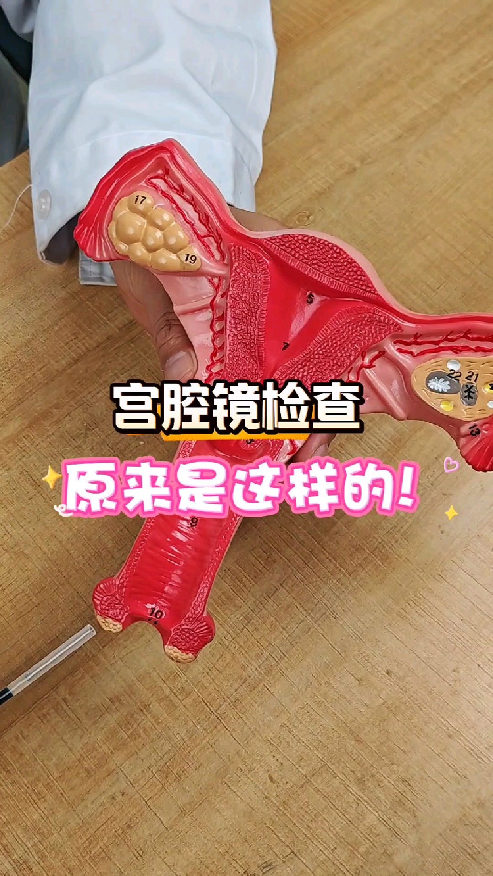 宫腔镜检查原来是这样的!
