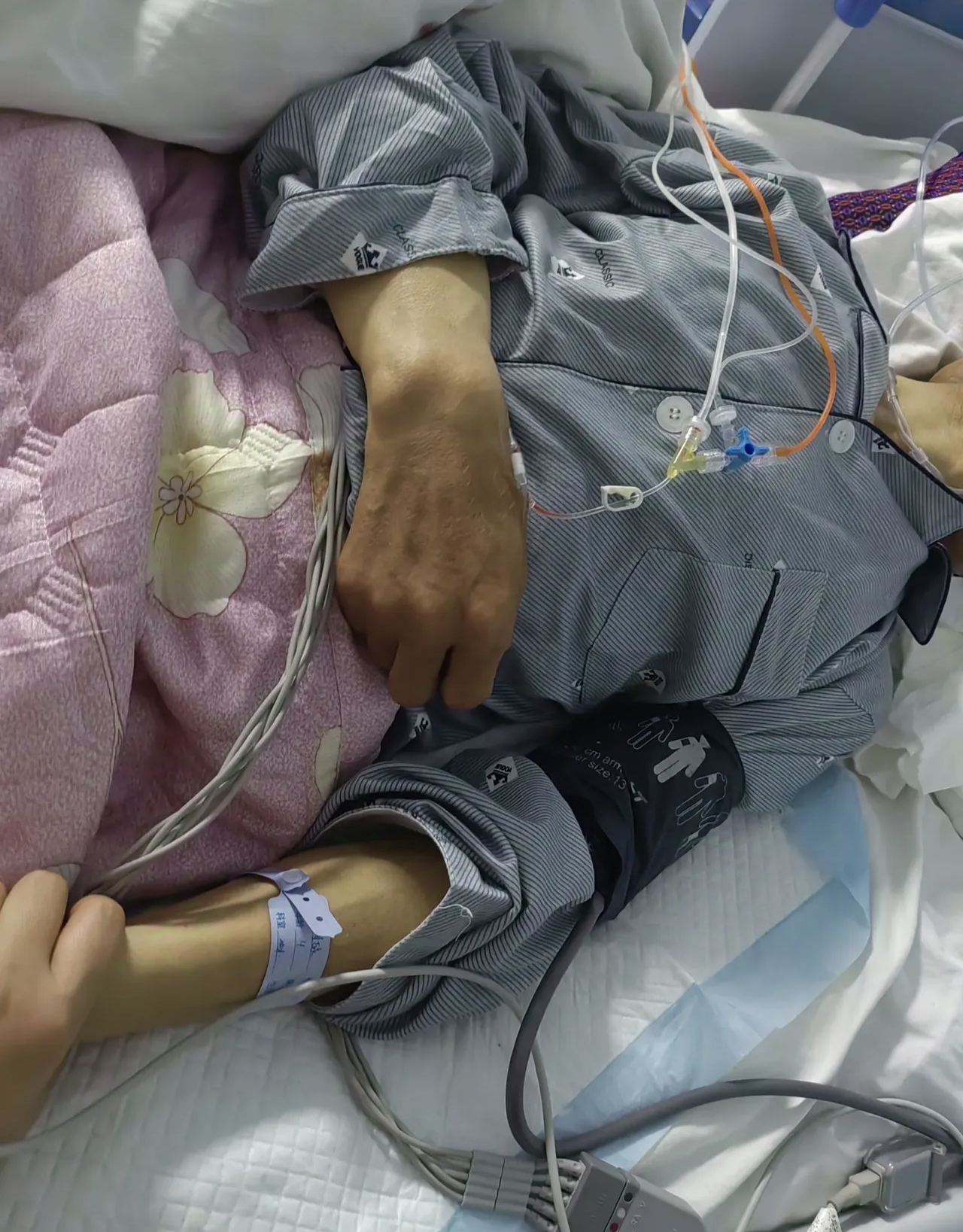 今年五一父亲突发脑出血昏迷不醒,出血量88以上,父亲本身就有高血压