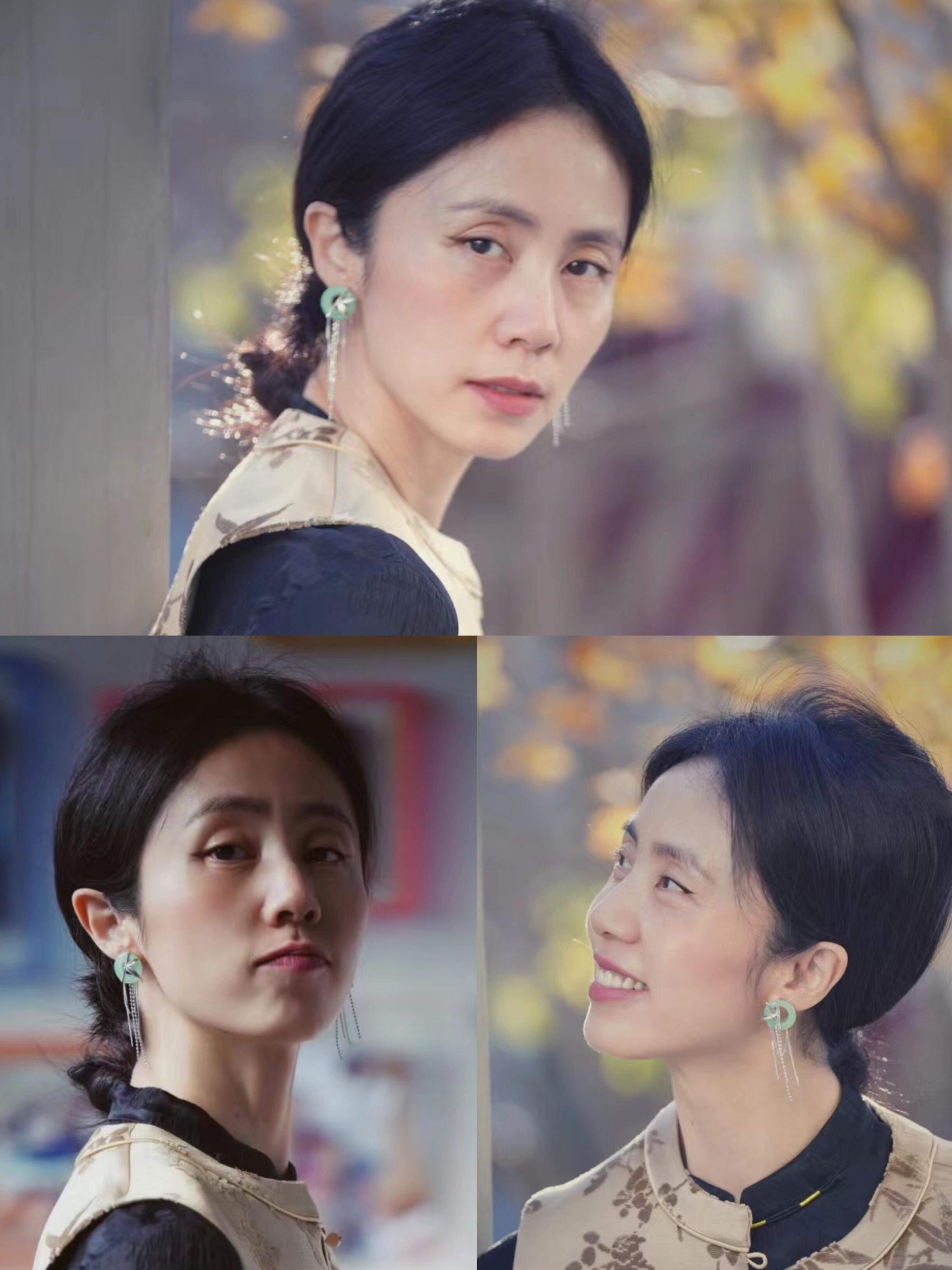 "  有网友表示:"孙莉一直是自然美的代表,不会是整容后遗症吧?