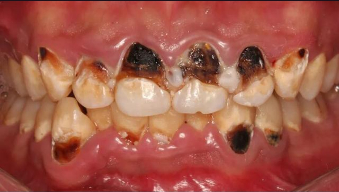 为什么牙齿很臭?百科在线 为什么牙齿很臭?百科在线