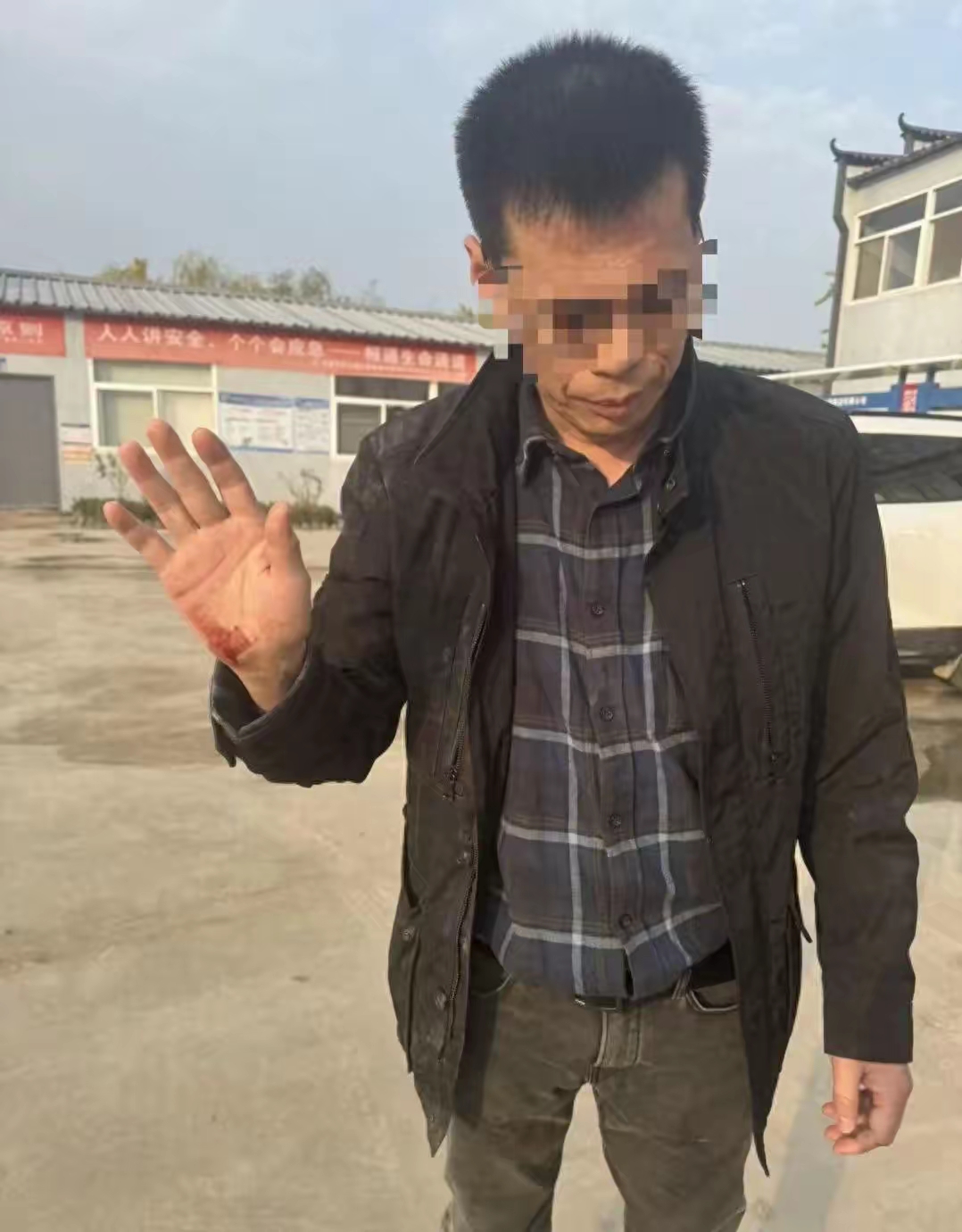 除了记者手机被抢夺外,王文志本人右手受伤