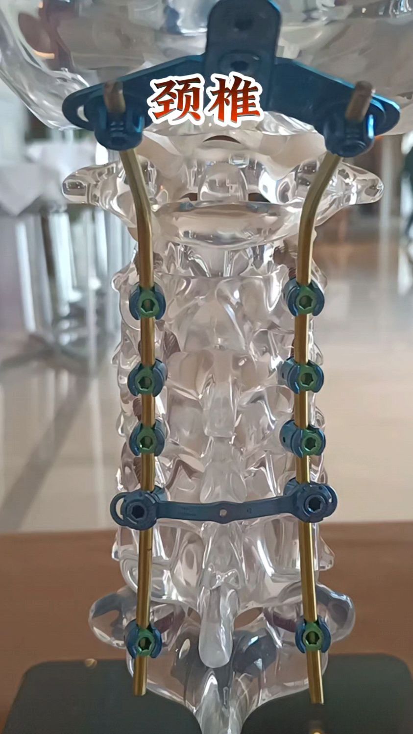 钉子打在颈椎,胸椎,腰椎里是什么感觉