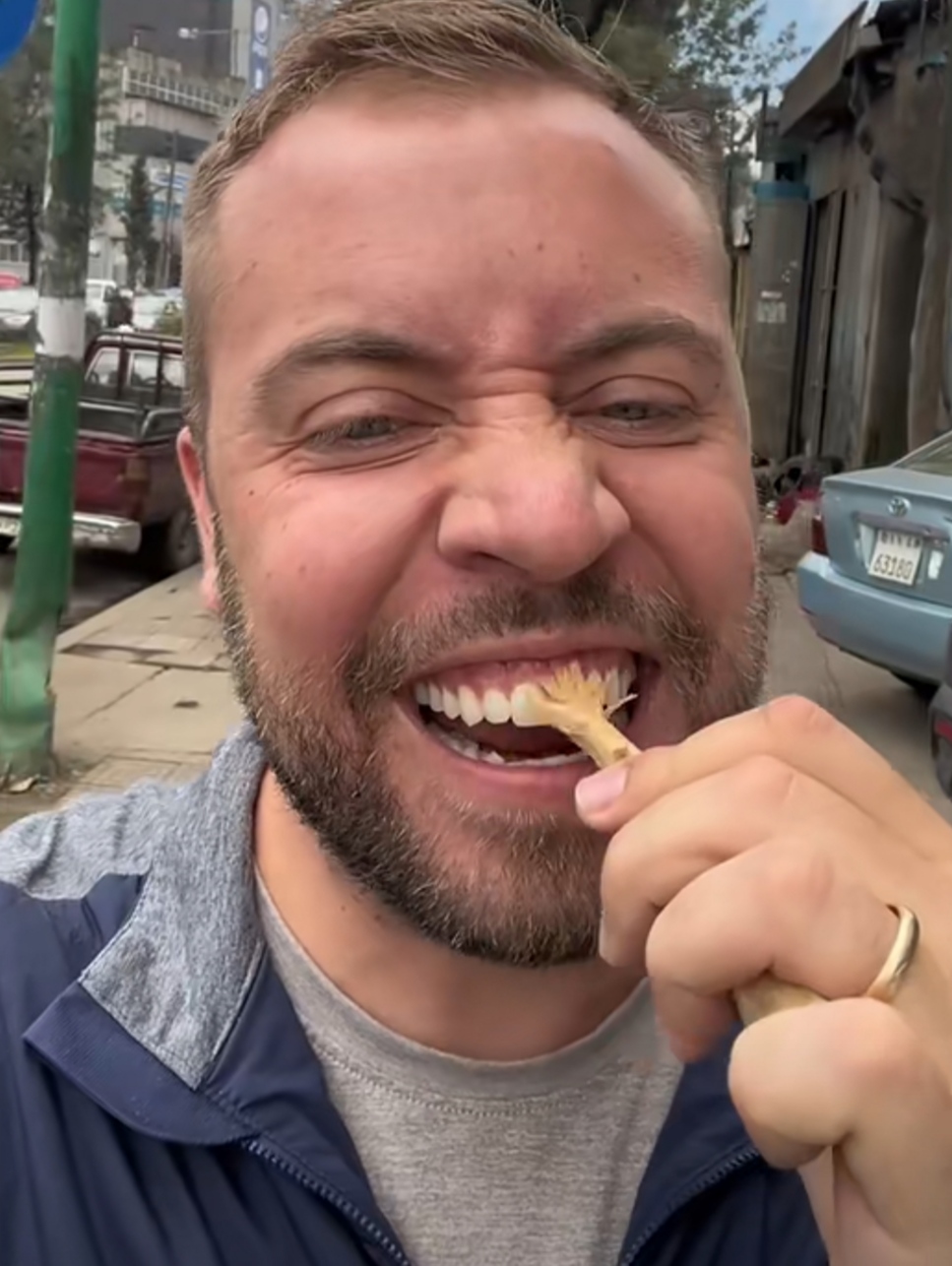 小时候第一次看到非洲人的时候,最让人感到惊讶的就是他们的牙齿真白