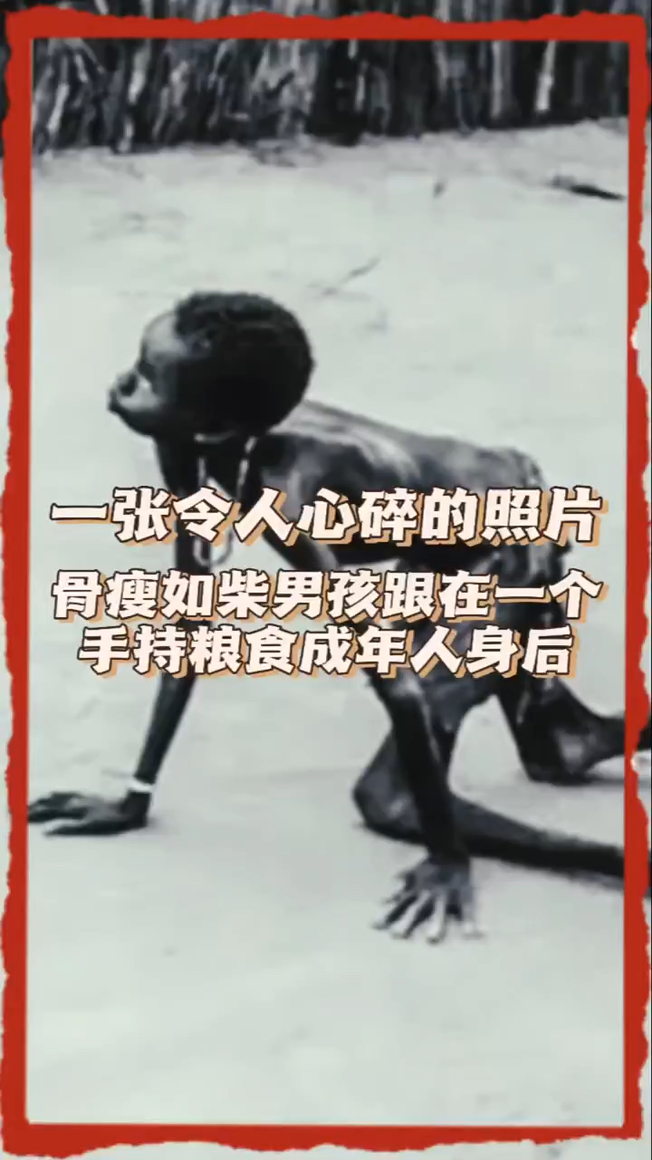 一张令人心碎的照片,骨瘦如柴男孩跟在一个手持粮食成年人身后