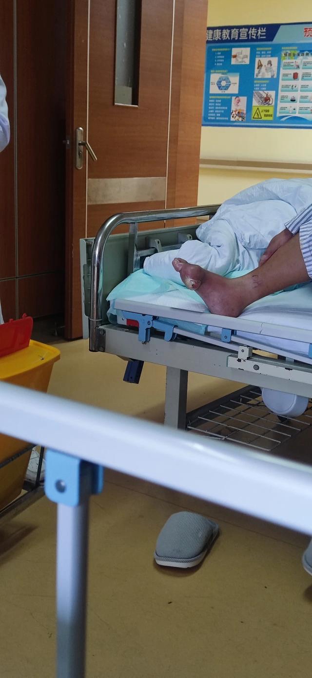 为什么打完飞机就犯痛风 为什么打完飞机就犯痛风