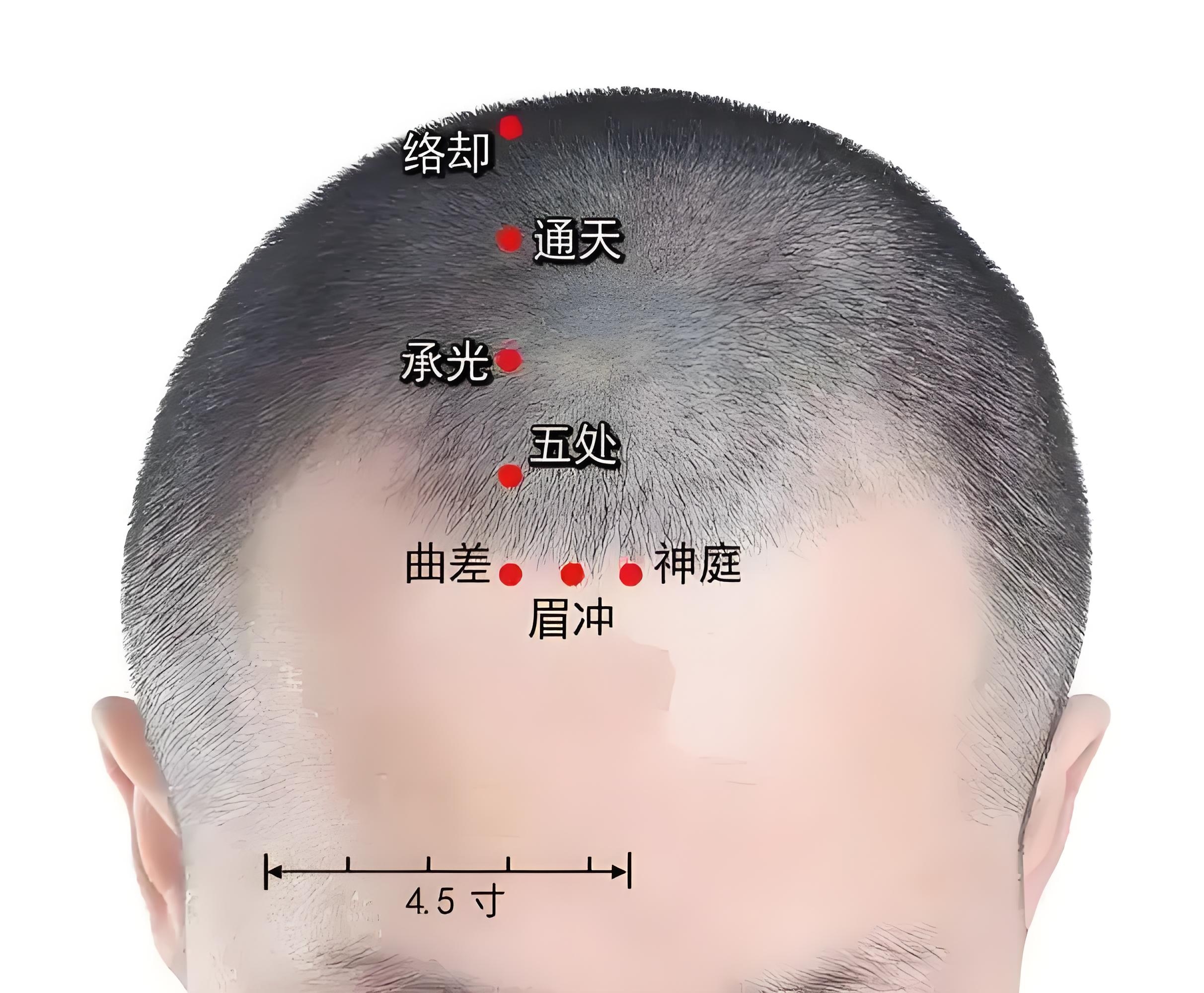 通天悬钟太冲的位置图图片