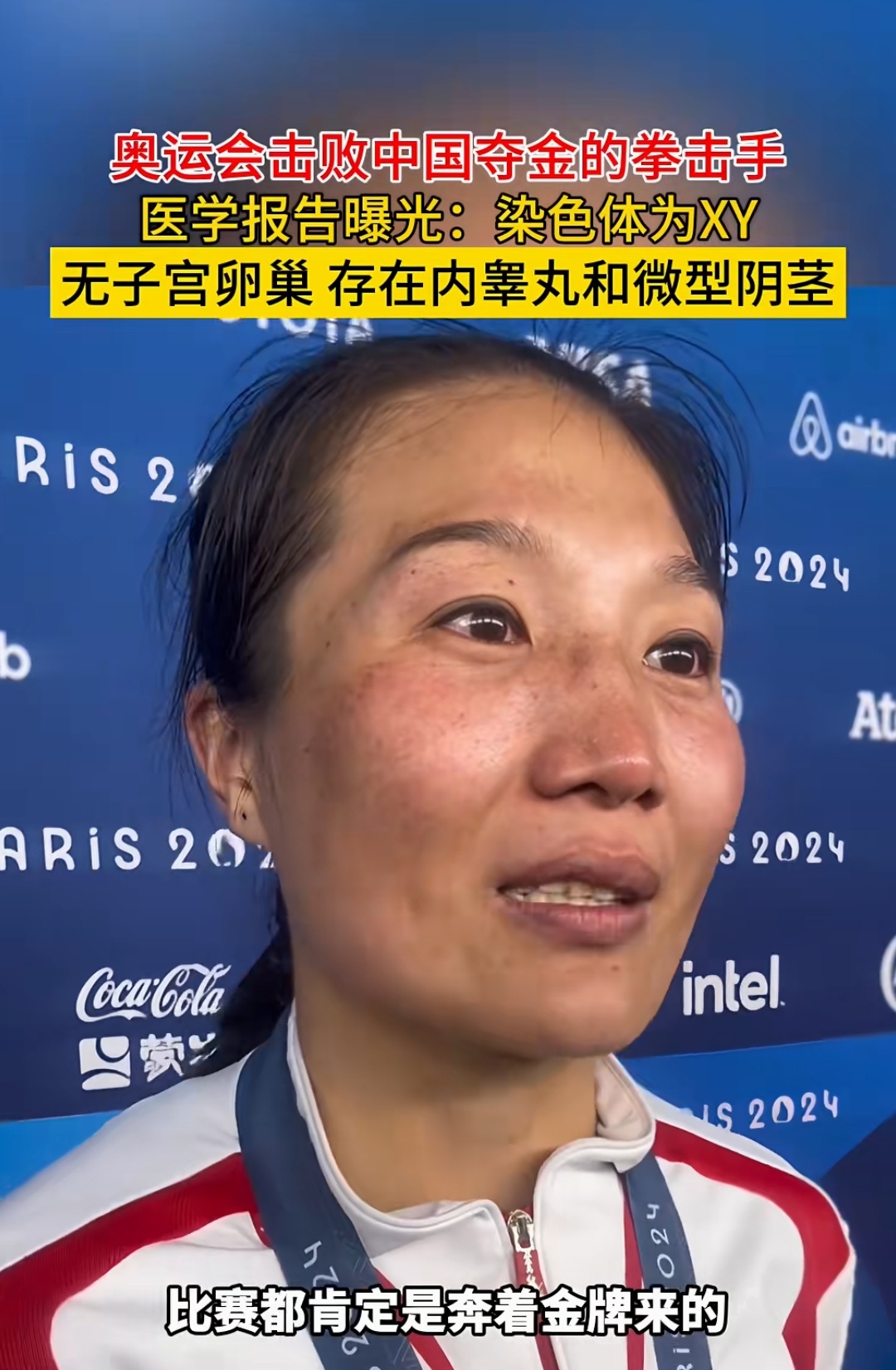 奥运会击败中国夺金的拳击手医学报告曝光:染色体为 x