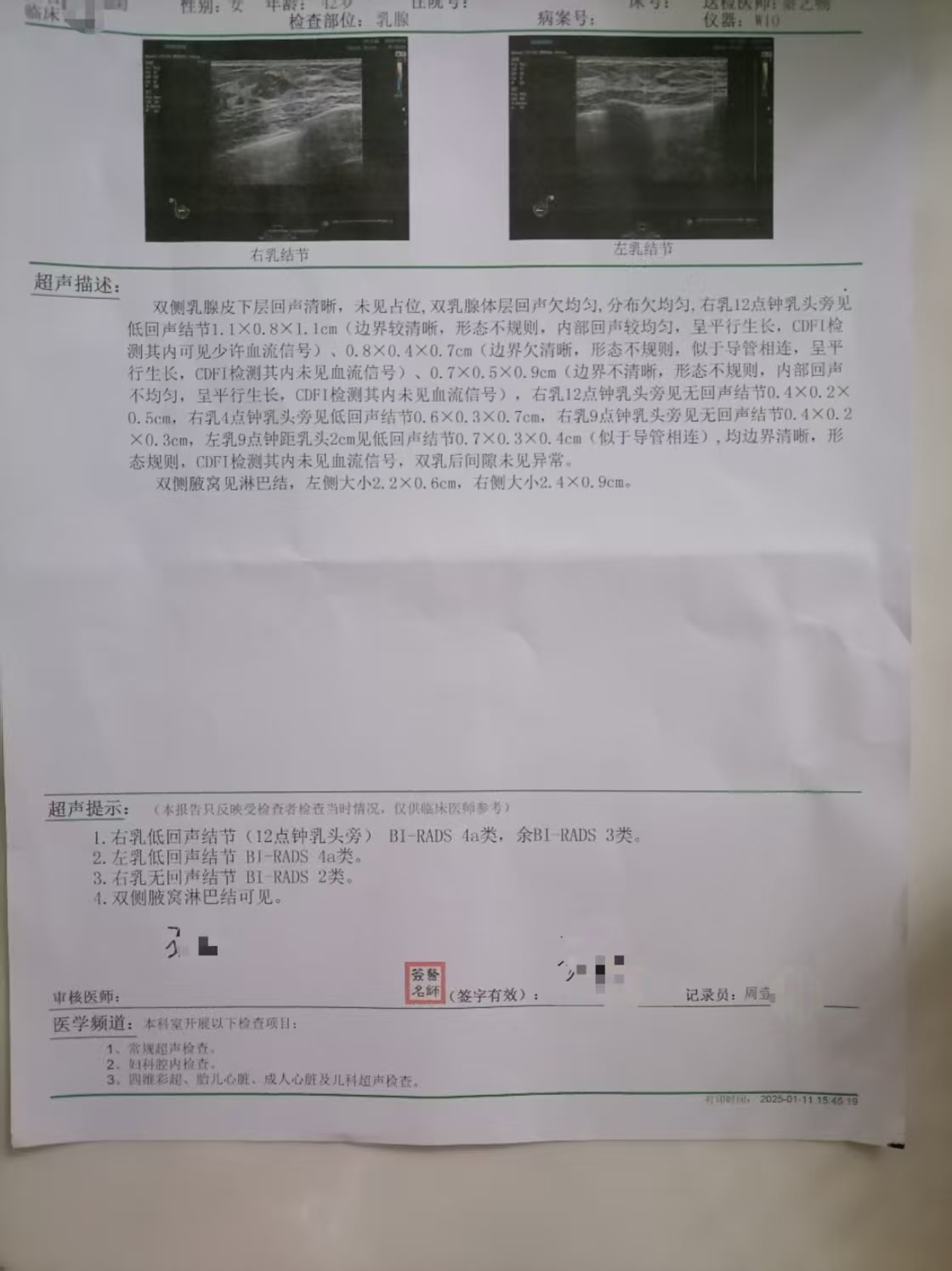 乳腺结节4a