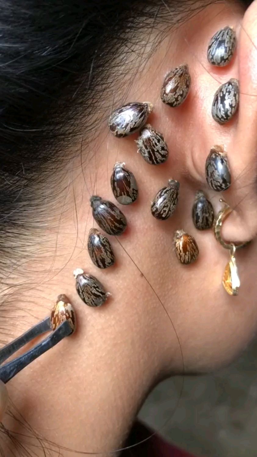 你没见过这样的虫子吗?皮肤都红了.