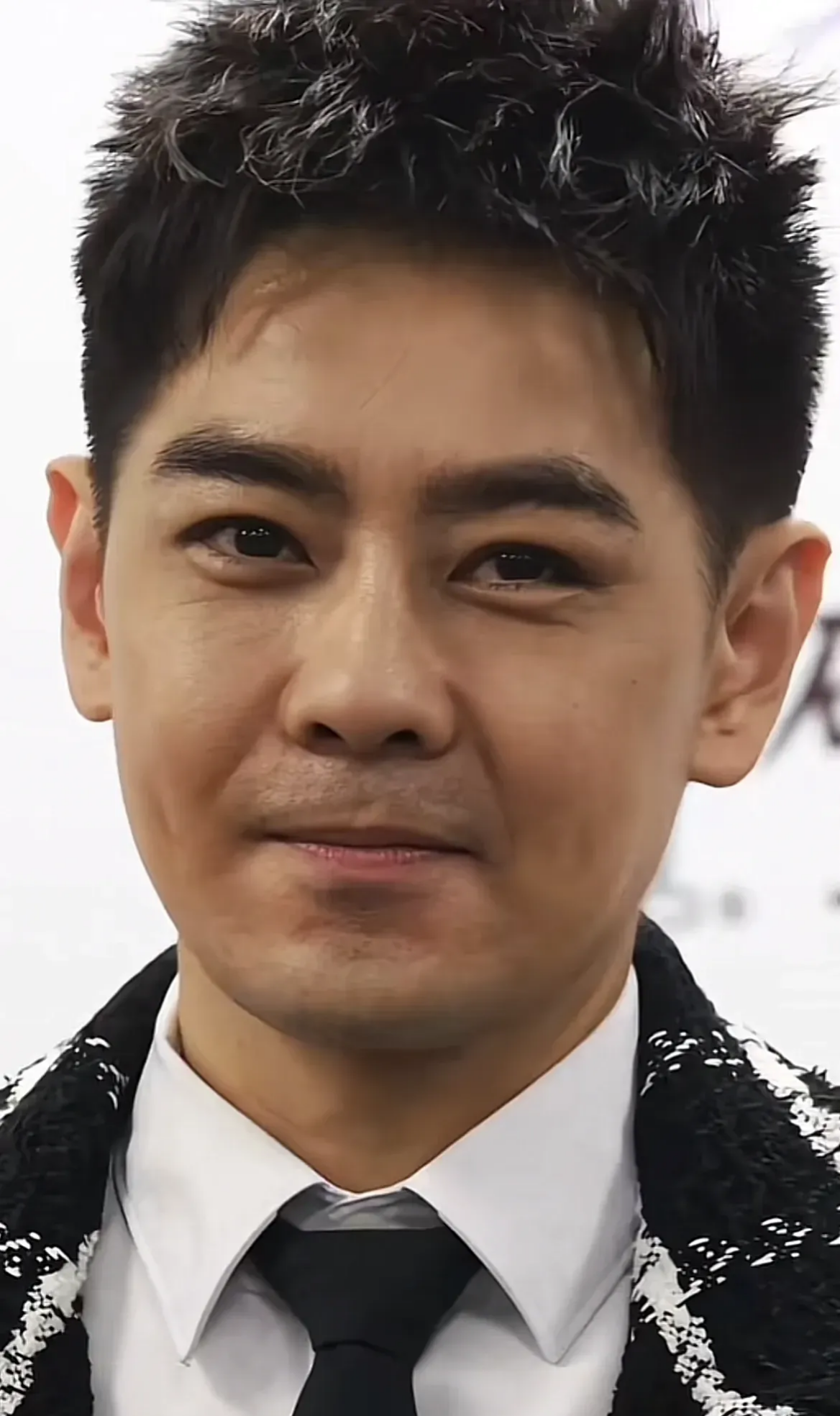 车祸给男神留下的后遗症太严重了,脸部明显不协调