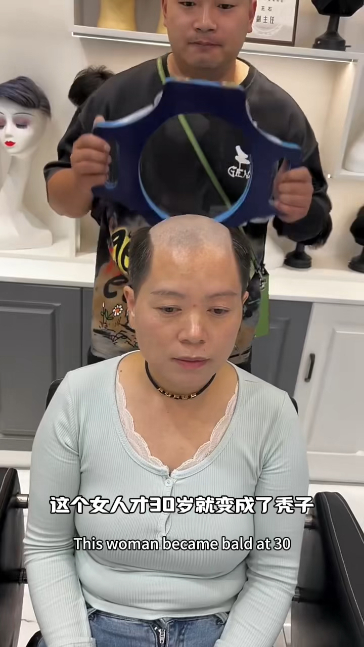 女人脱发严重,所以只能戴假发.#搞笑