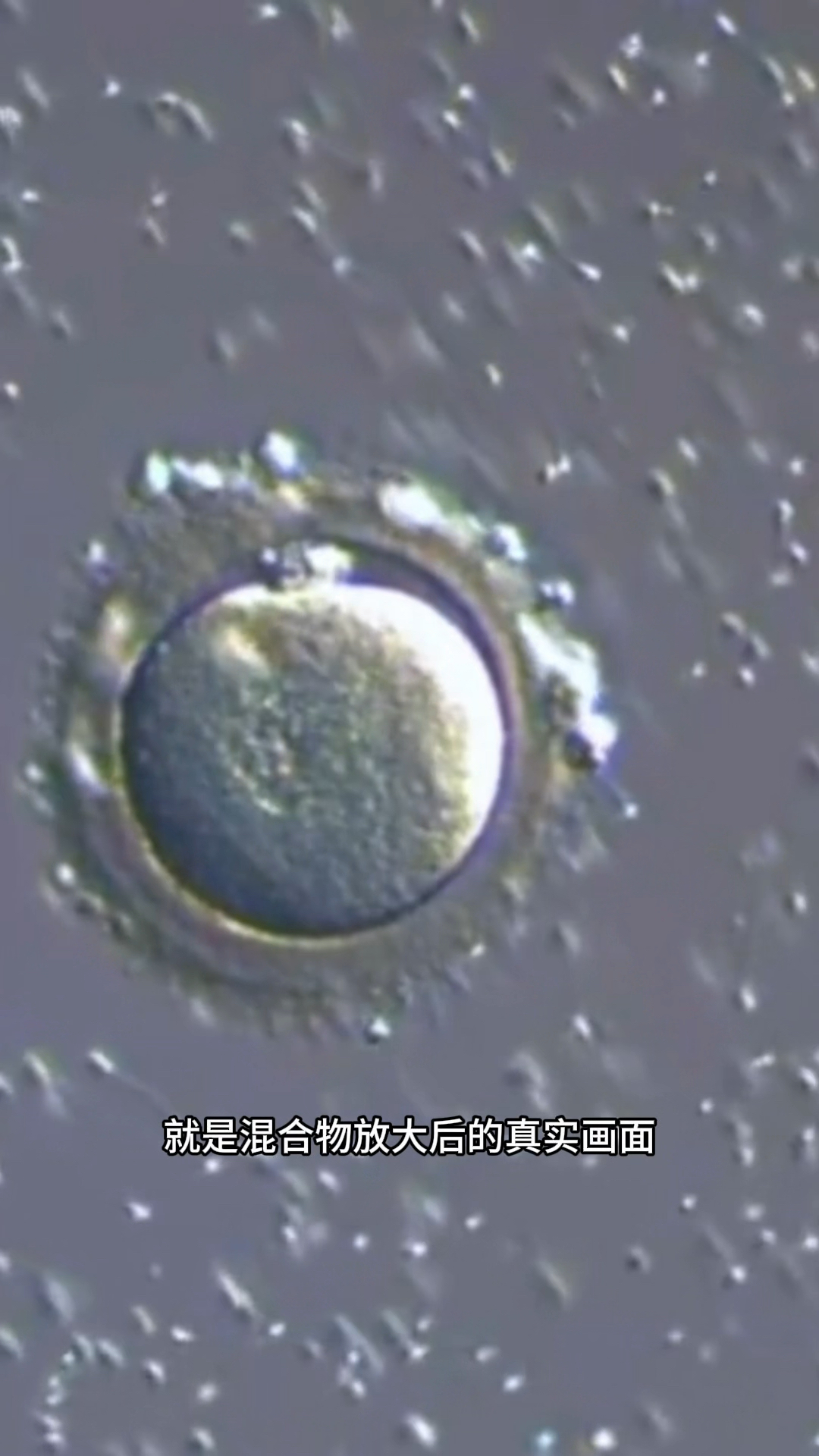 卵子多大_卵泡多大是成熟  第2张