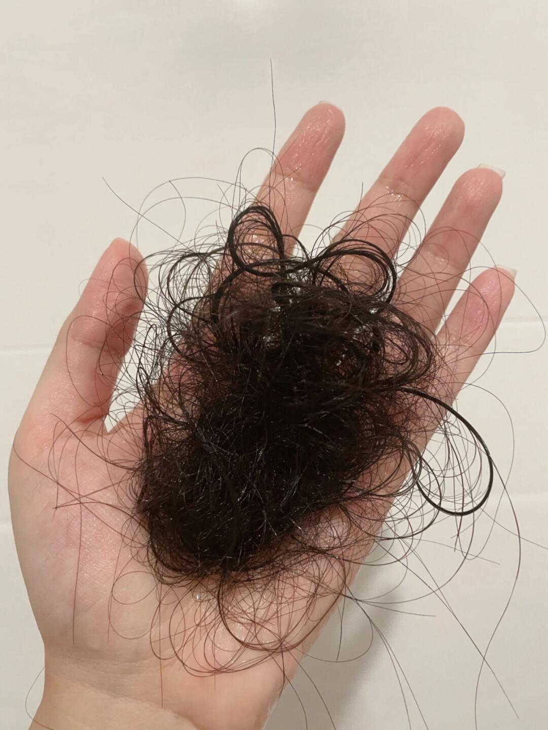 头发脏了为什么容易掉头发