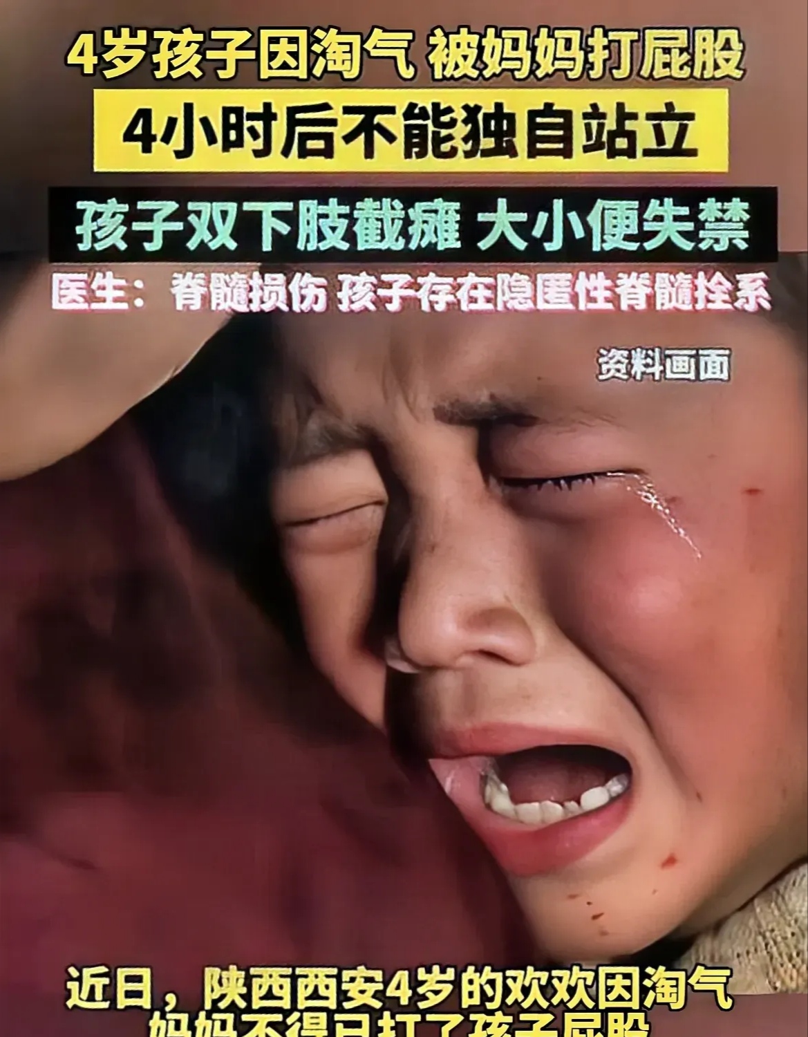 陕西西安一4岁小女儿因为淘气不听话,妈妈一气之下打了孩子的屁股
