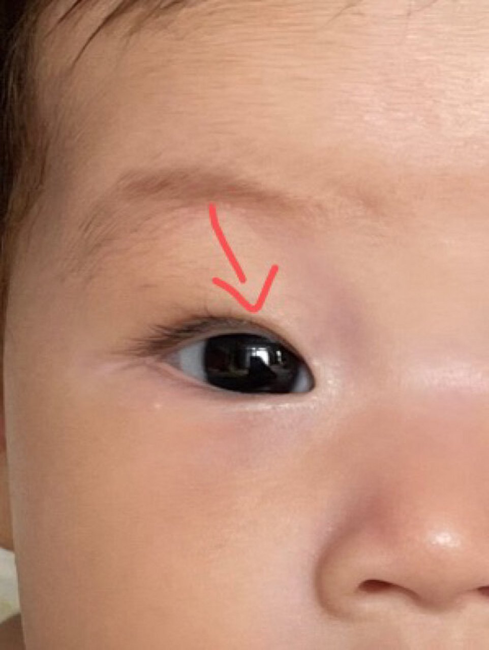 为什么宝宝出生是双眼皮,养着养着就变单了,3个原因爸妈要知道
