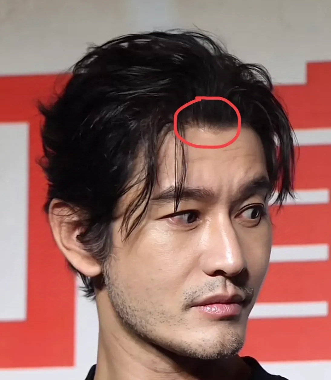 精气神也没了,官宣后明显苍老了好多,仔细看甚至能看到额头上的假发胶