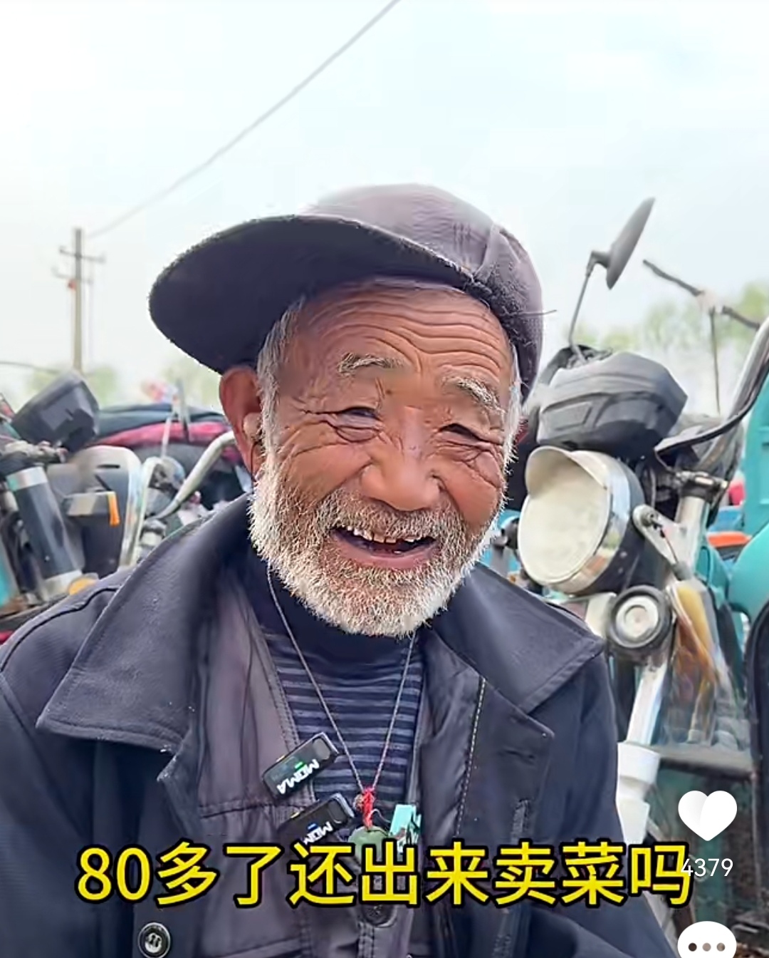 老人85岁生产队时代冻伤手至今发抖
