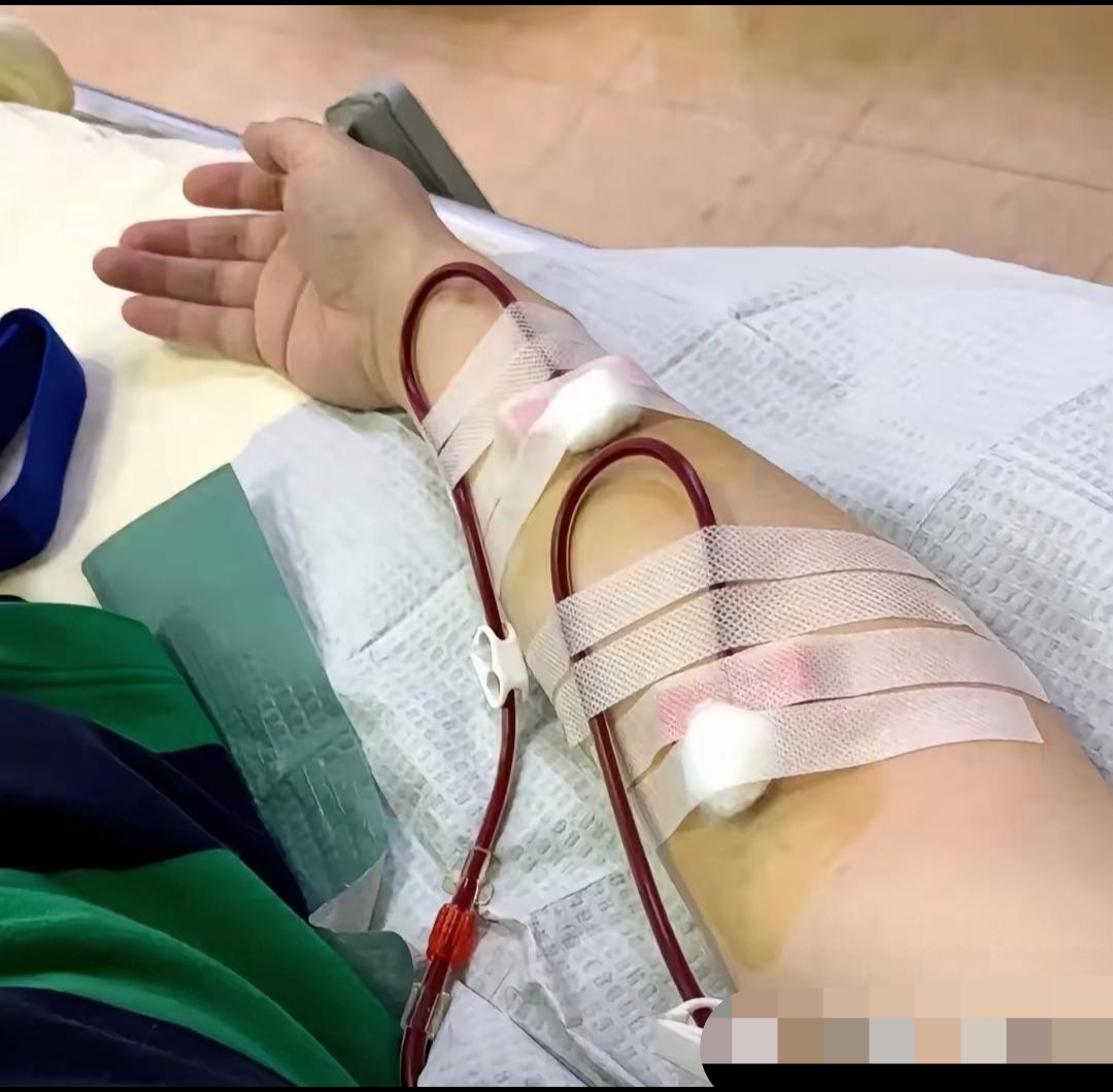 献血针头为什么那么粗