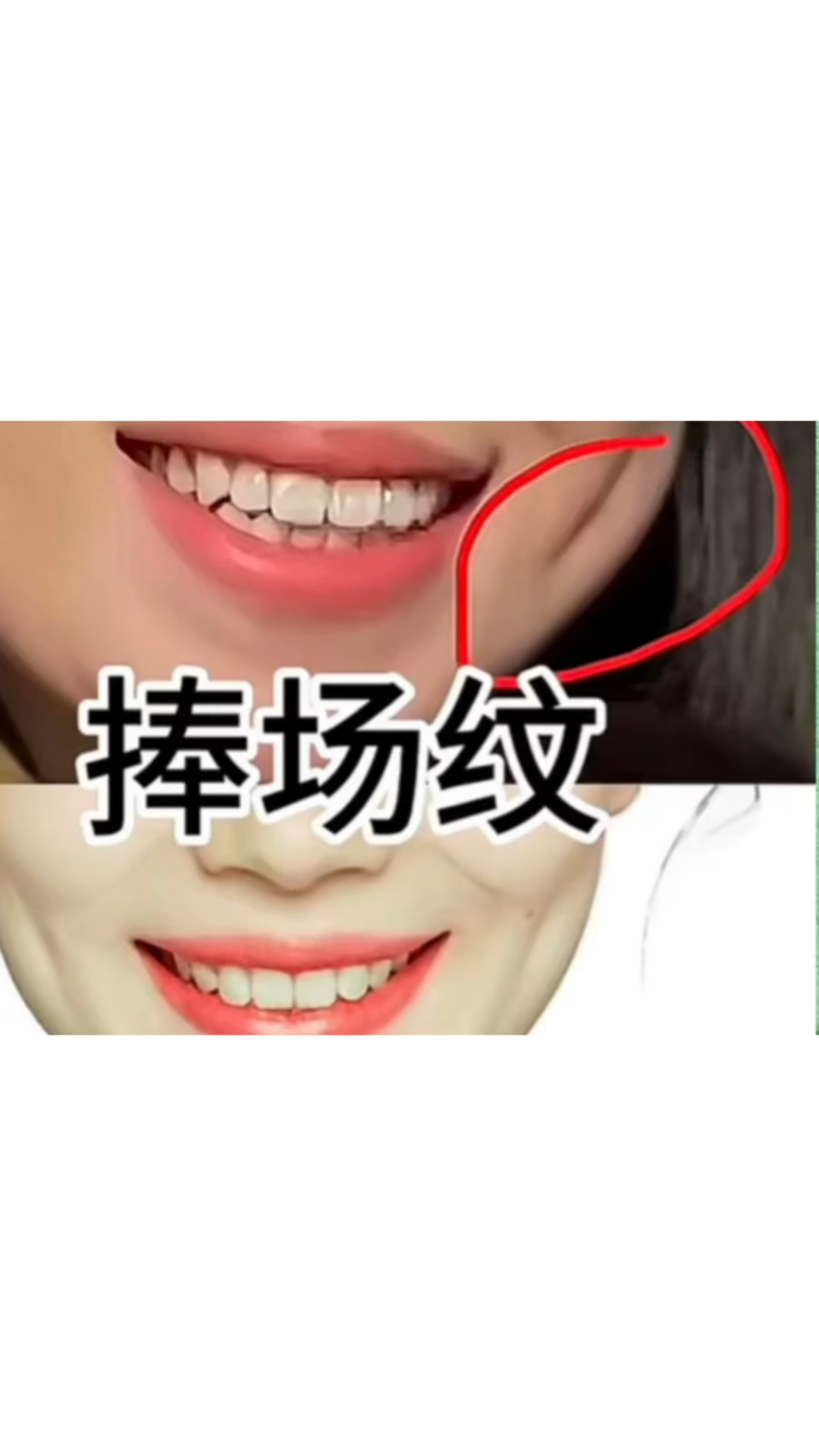捧场纹到底什么意思