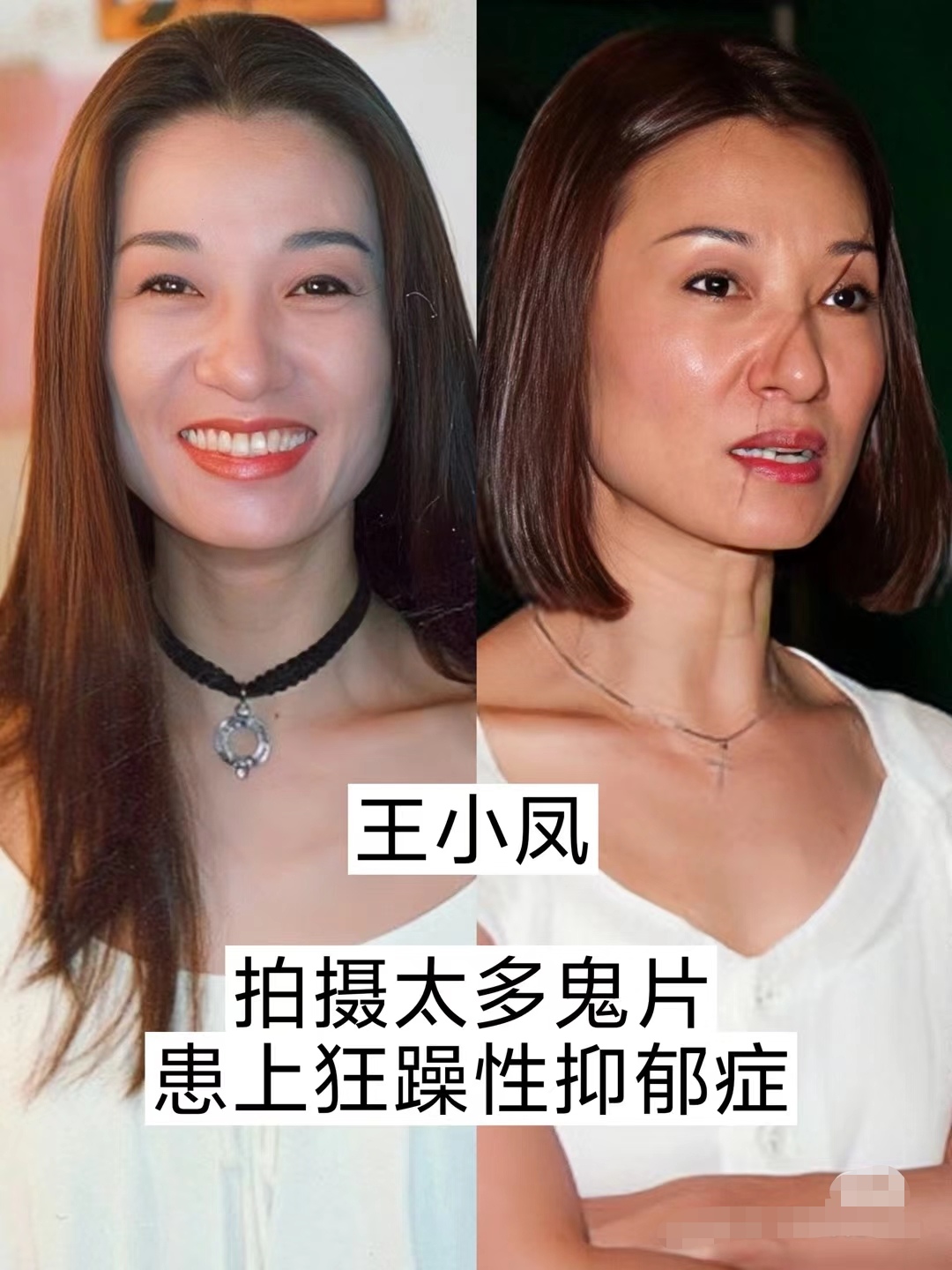 因拍戏导致终身残迹的明星