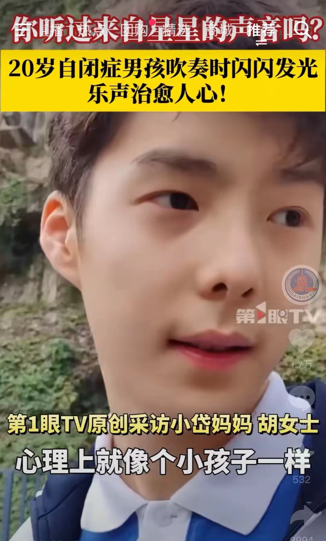 嘿您知道不20 岁自闭症男孩吹奏乐器火遍全网啦