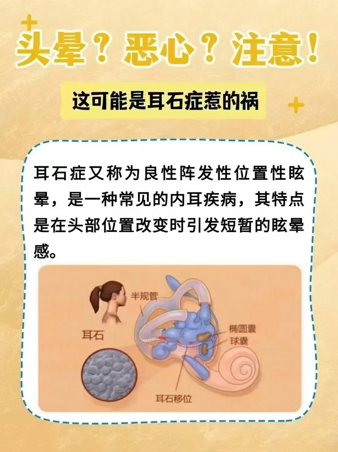 耳石症虽然让人晕头转向但只要积极治疗很快就能恢复