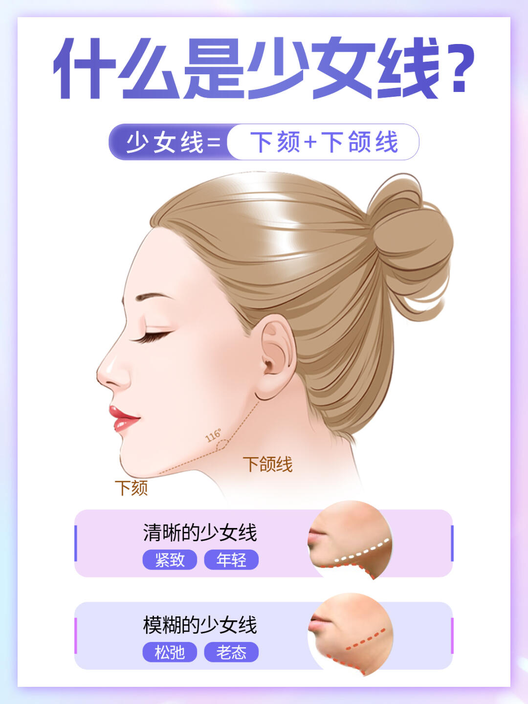 少女线也叫轮廓线,美人线,主要表现面部下颚轮廓清晰的线条 少女线的