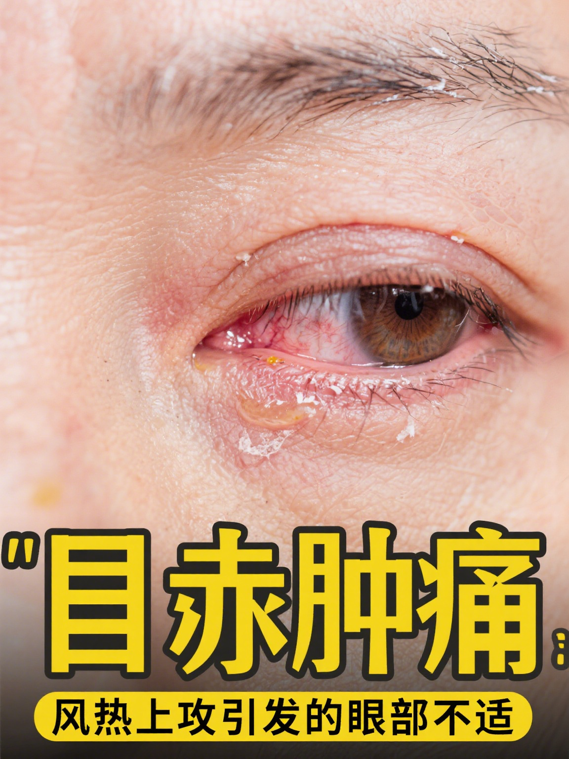 白蒺藜的功效和作用 白蒺藜是一味常见的中药材,在