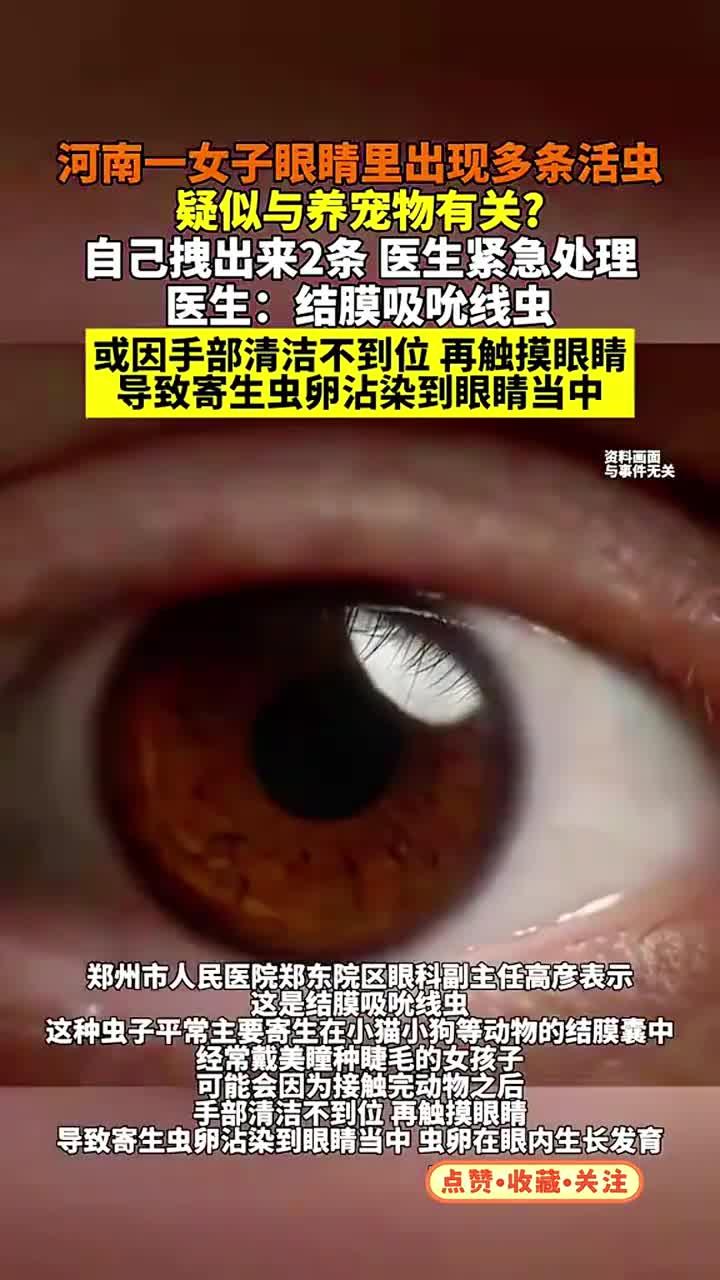 河南一女子眼睛里出现多条活虫,疑似与养宠物有关?自己拽出来2