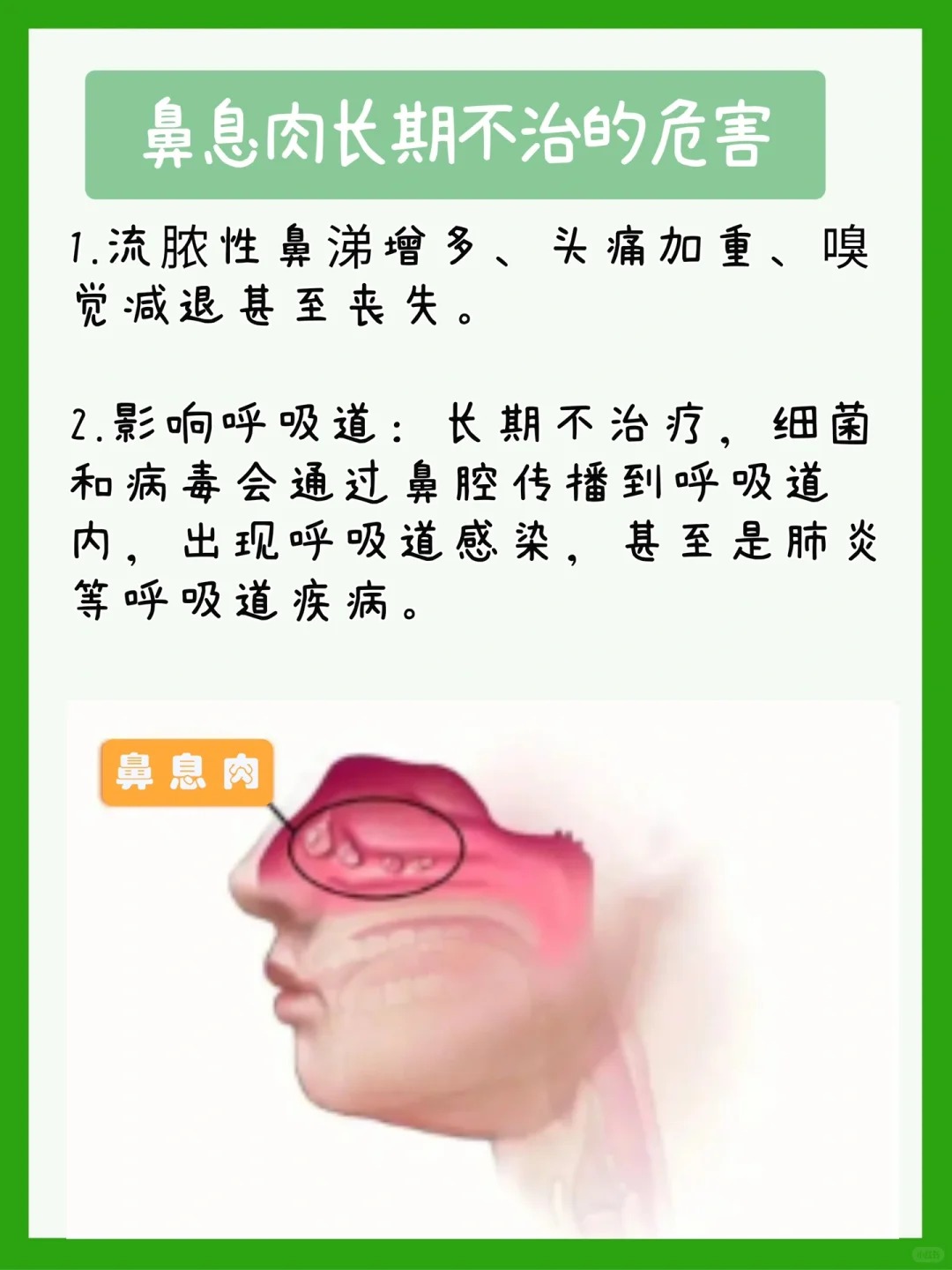 鼻息肉不手术可以治愈吗 鼻息肉不手术是否能治愈要根据息肉的大小