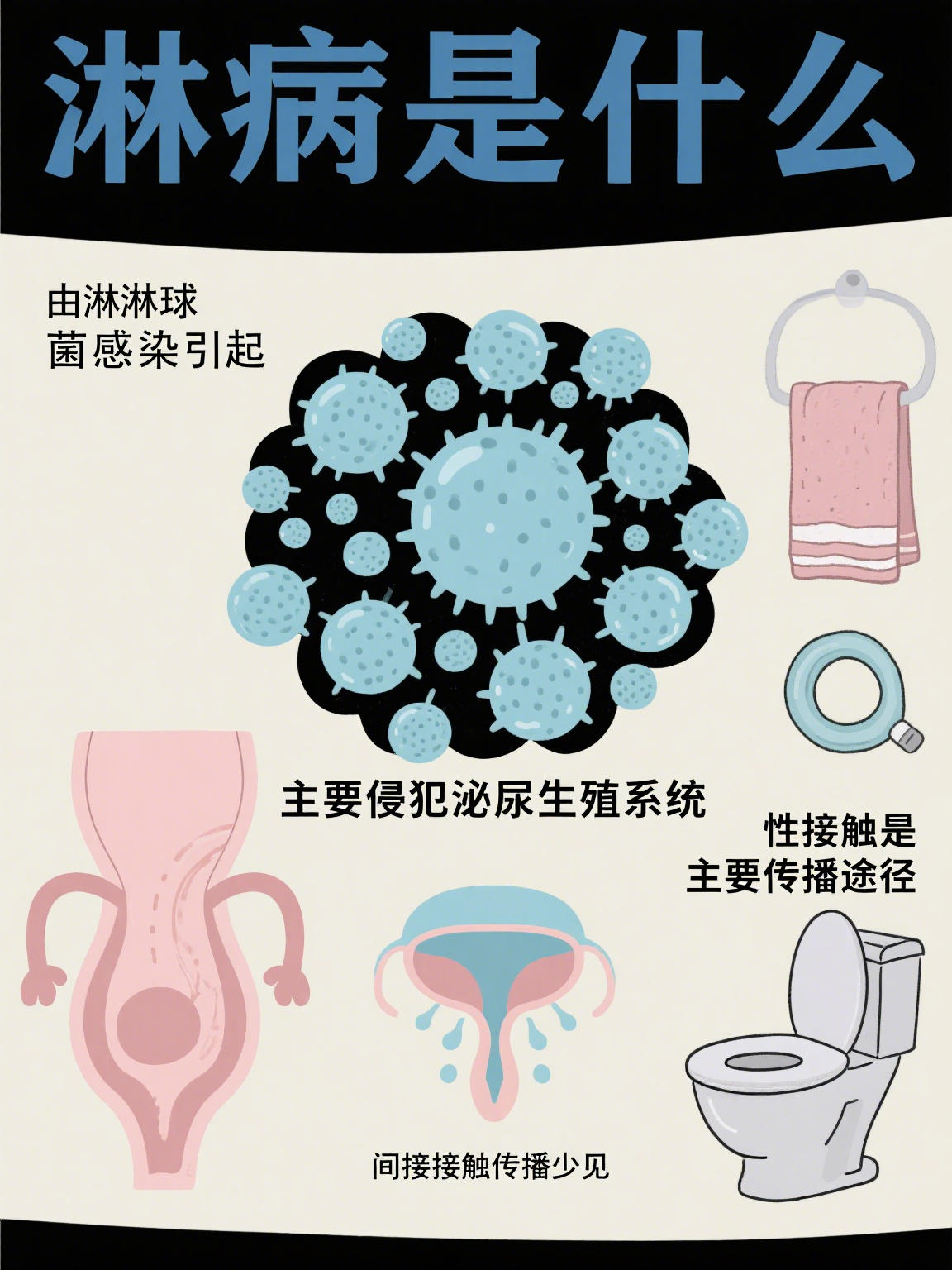 淋病是什么原因引起的 淋病是由淋病奈瑟菌