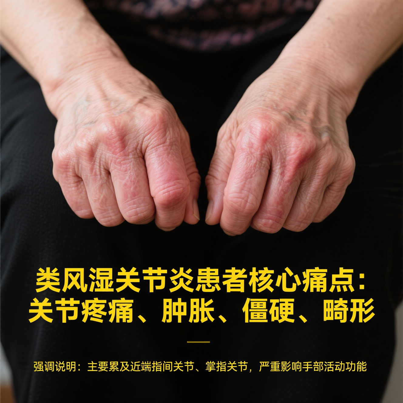 类风湿关节炎是一种常见的慢性自身免疫性疾病,困扰着不少患者