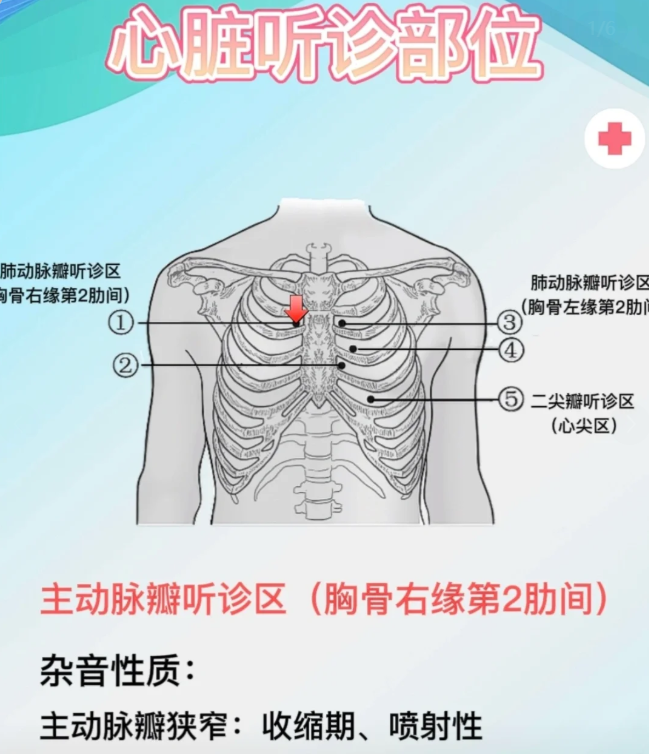 这里是听诊二尖瓣声肺部听诊的部位及顺序心脏听诊区吸痰听诊部位肺尖