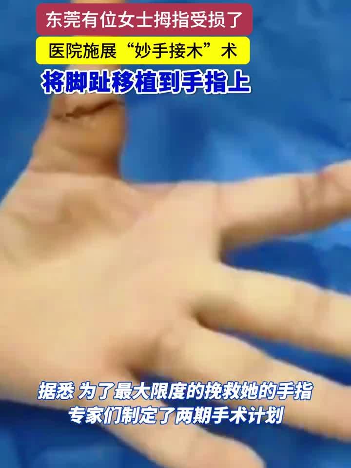 一女子拇指不慎损毁,医院"移花接木",将脚趾移植到手指上