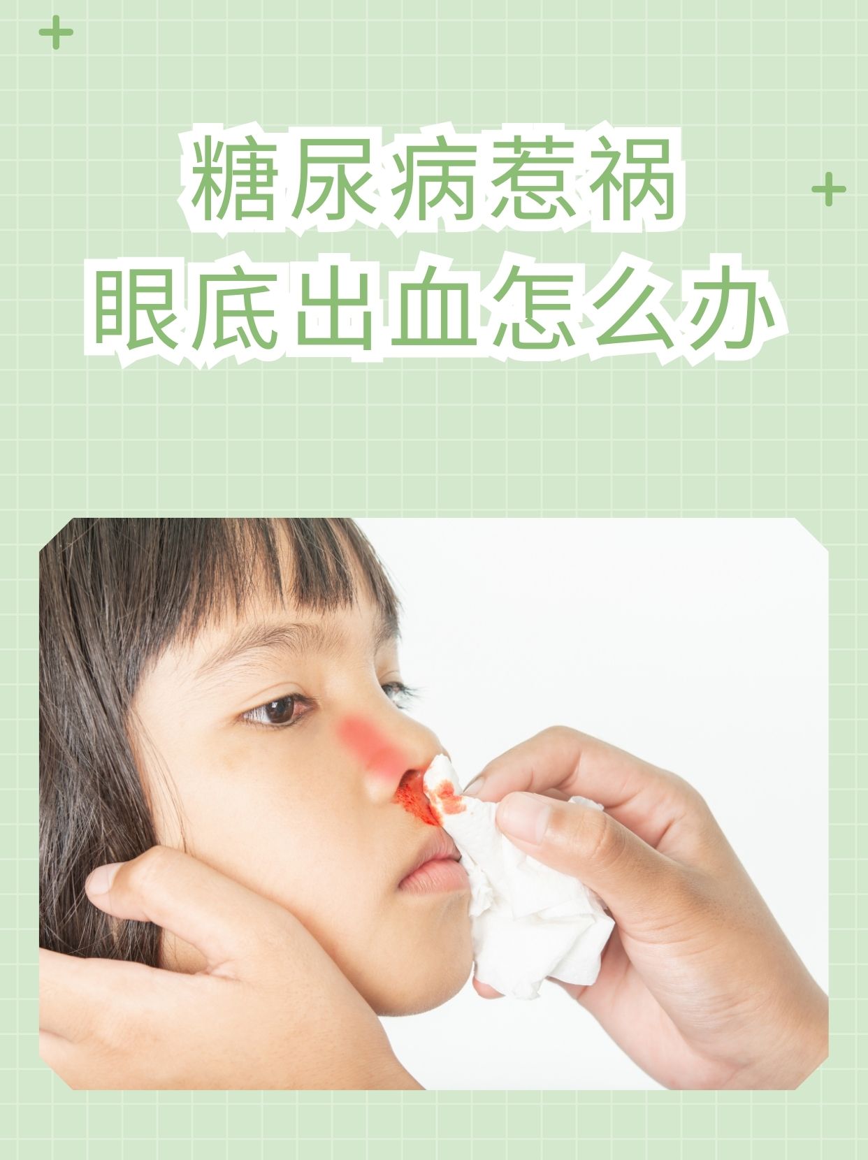 糖尿病惹祸,眼底出血怎么办  糖尿病引起的眼底出血就是一种较为严重