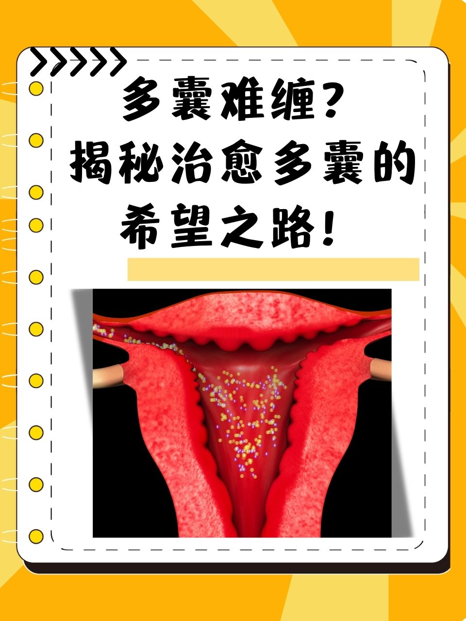 得了卵巢多囊有可能怀孕吗_得了卵巢多囊有可能怀孕吗女性  第2张