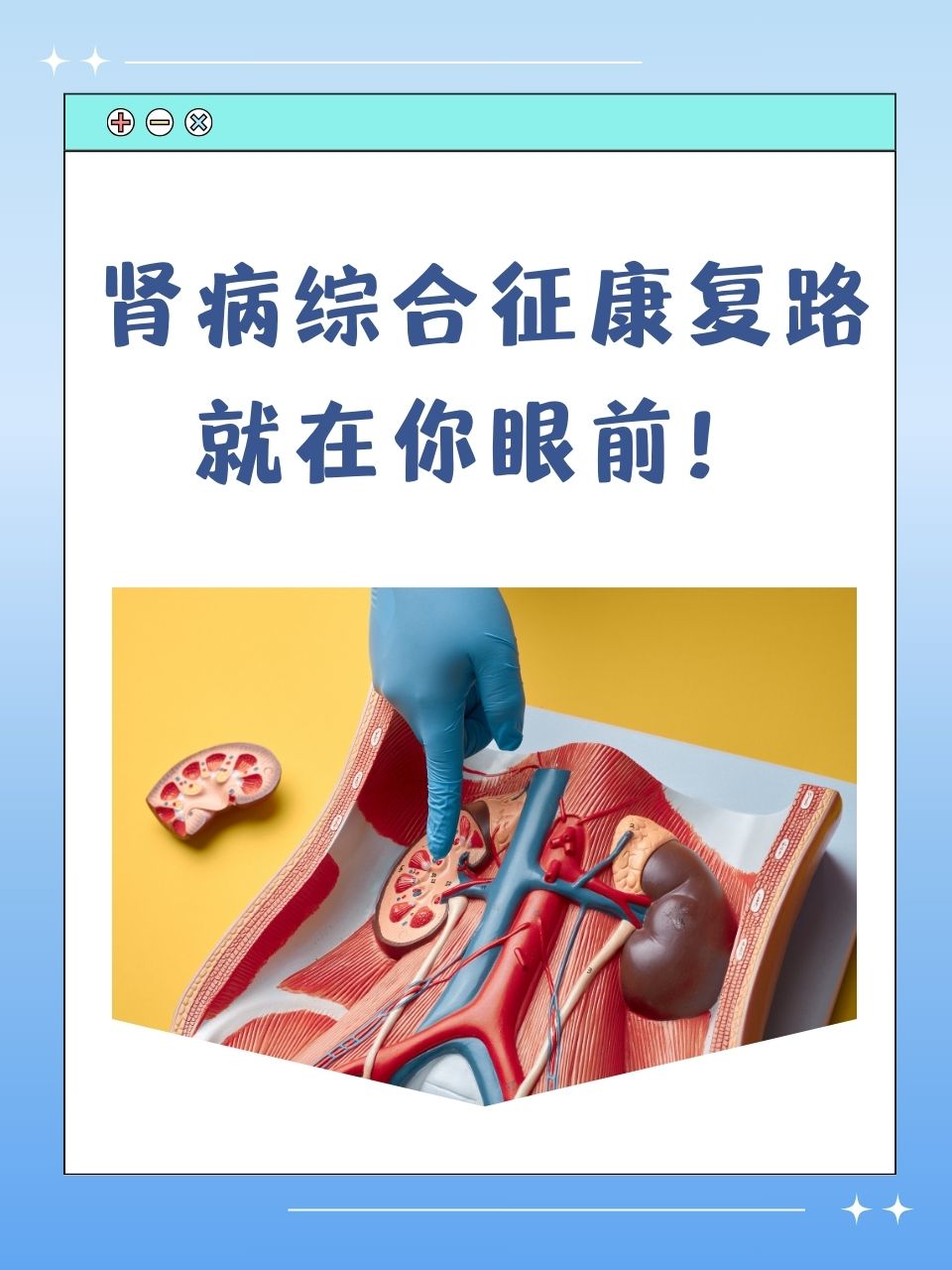 肾病综合征