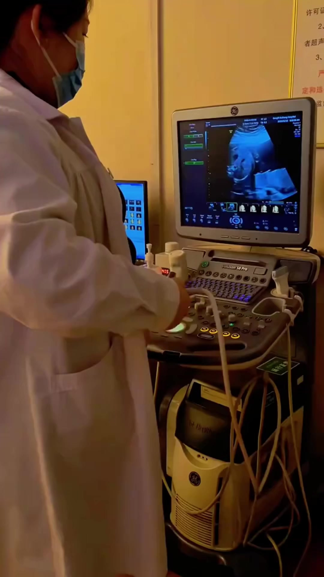 孕妈妈日常当超声医生怀孕了,天天就想看着仔在肚子里干嘛