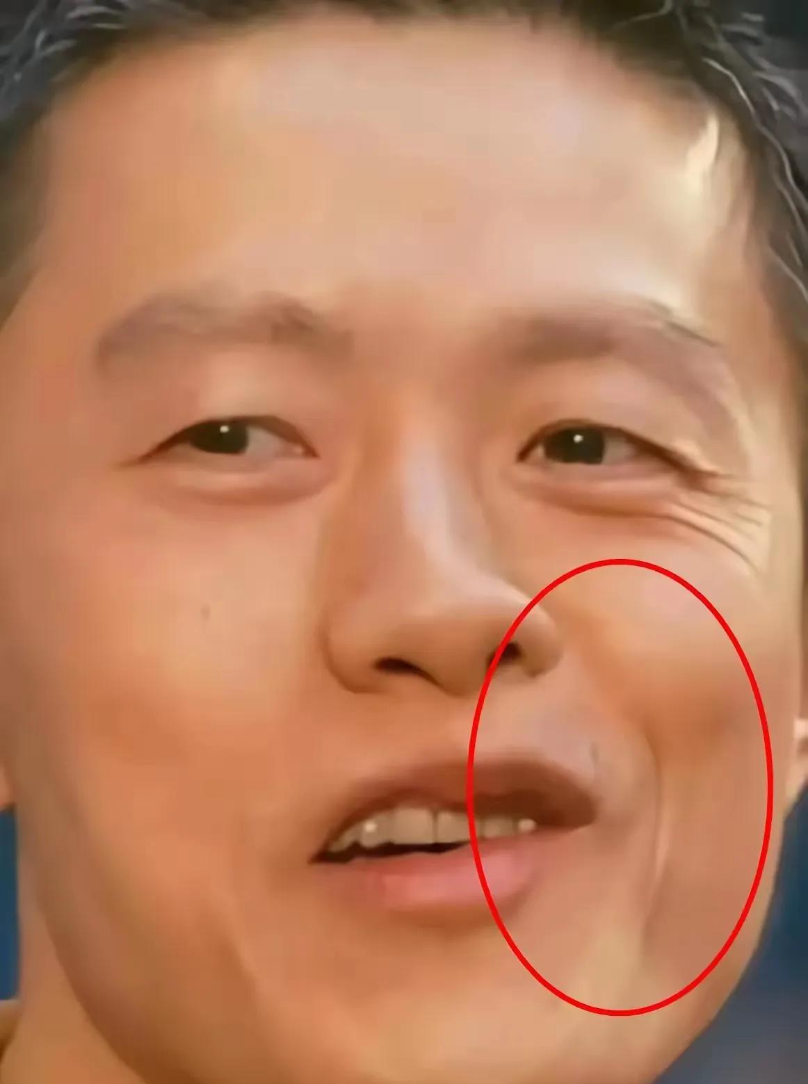 饺子导演这面相有点一言难尽,是什么原因导致的嘴歪眼斜,有人说长期吃