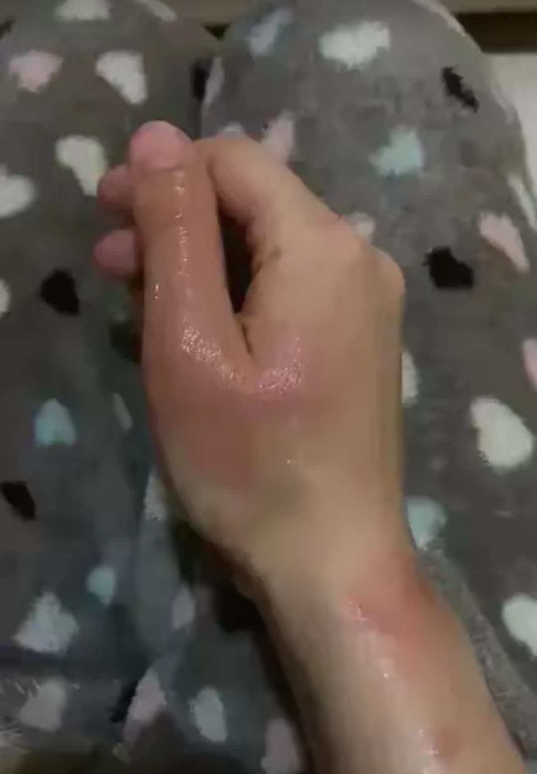 阿姨手受伤没办洗澡