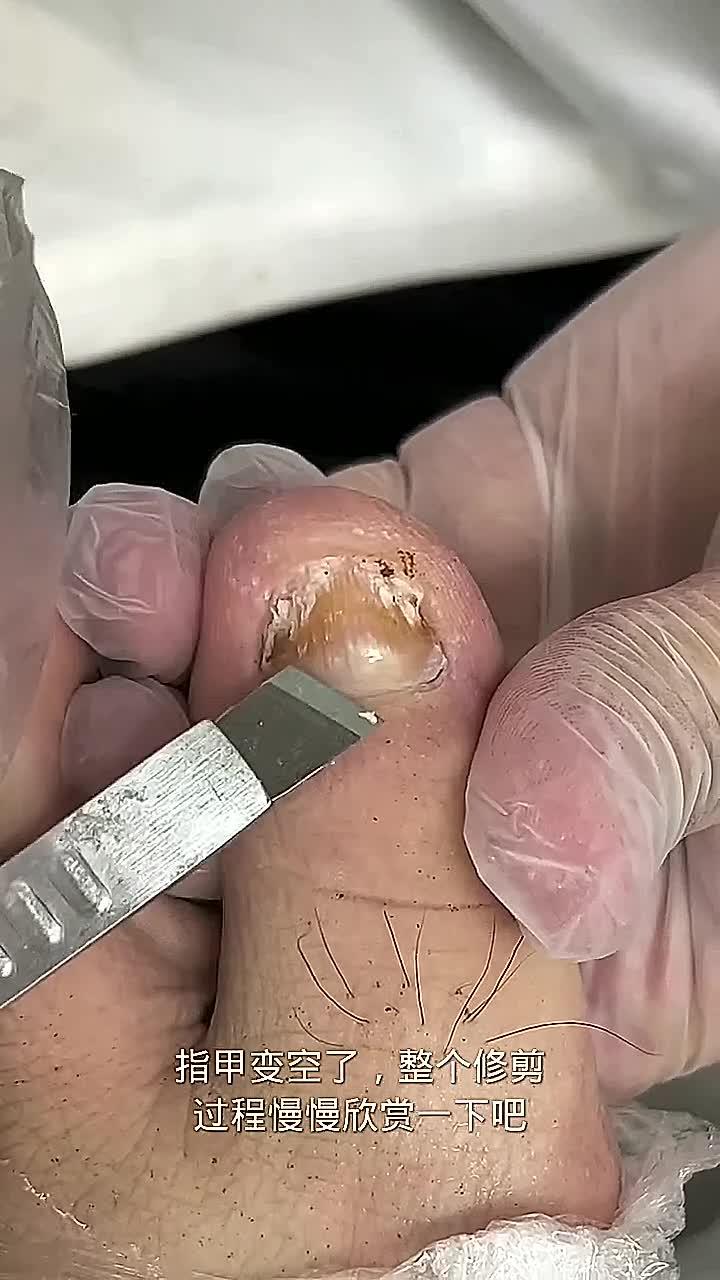 指甲变空了