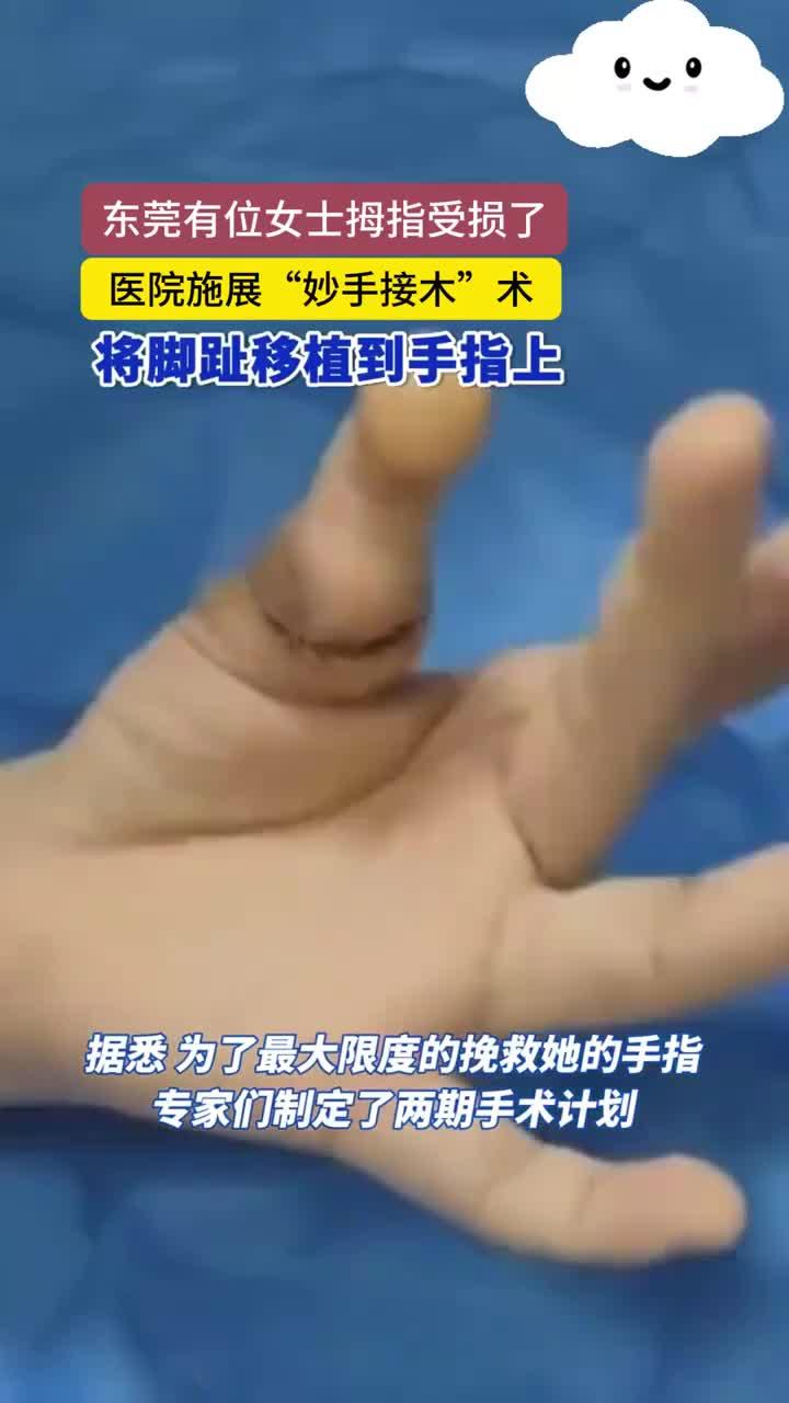 一女子拇指不慎损毁,医院"移花接木",将脚趾移植到手指上