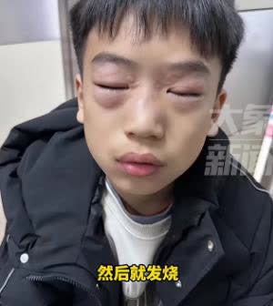 为什么脸发热 为什么脸发热