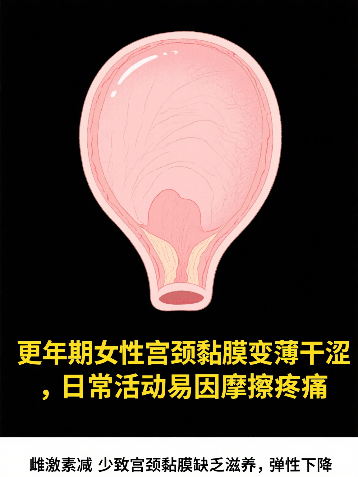 其实,这主要与更年期女性体内激素水平的剧烈变化有关