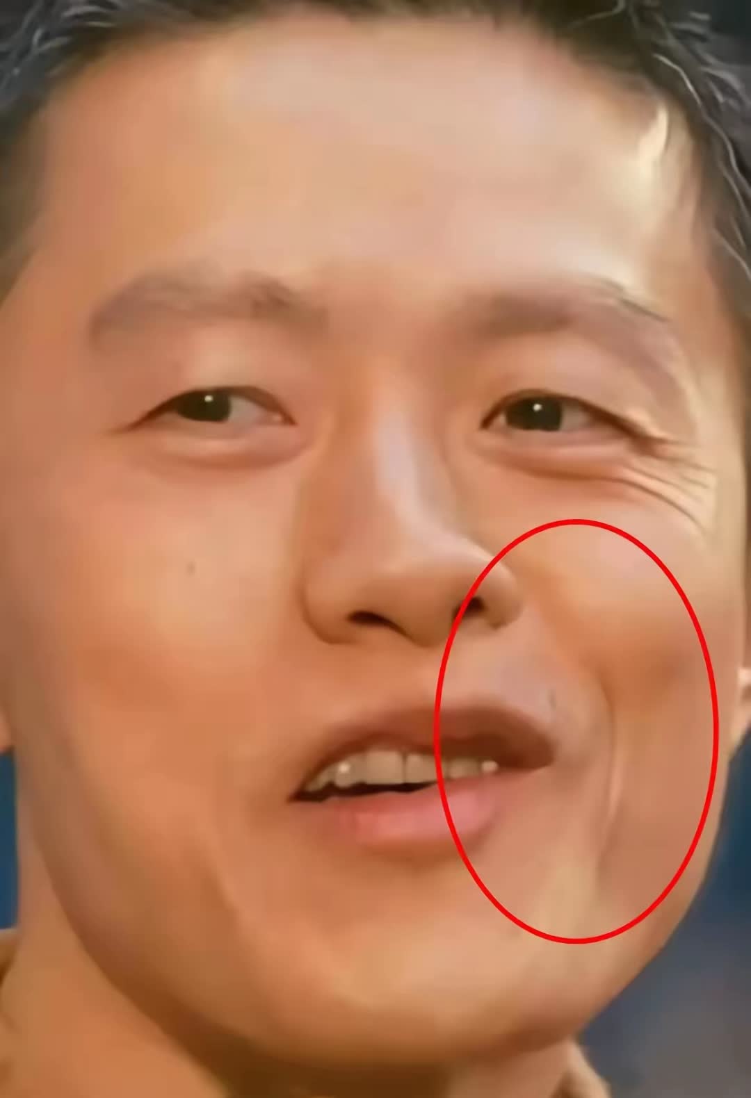 没成功,就是歪嘴歪鼻子,相由心生,心术不正,成功了,就是奇人有异相