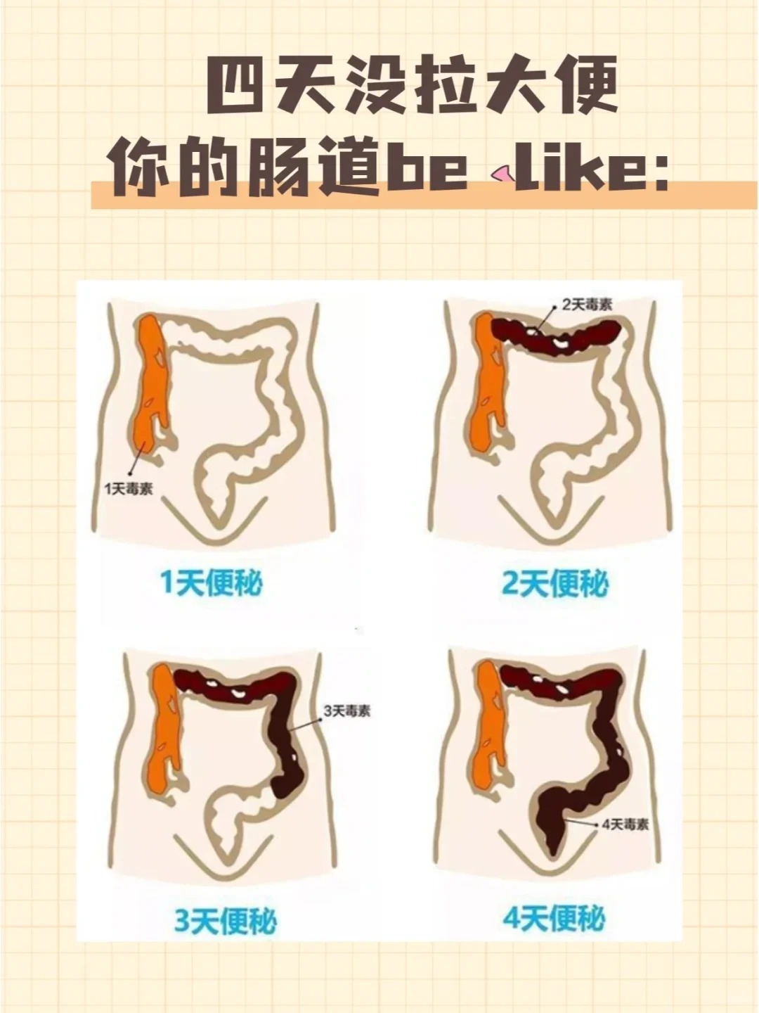 经常性便秘 经常性便秘是指每周排便少于3次且粪便干硬排出困难