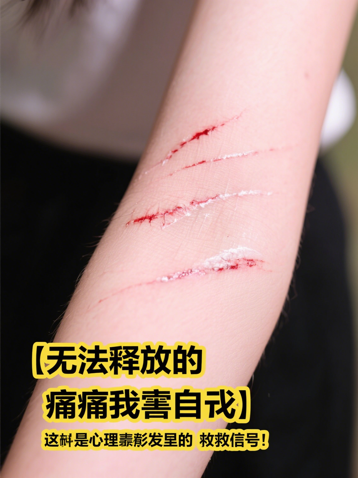 14岁女孩总用小刀划胳膊 14岁女孩总用小刀划胳膊,这一行为背后往往藏