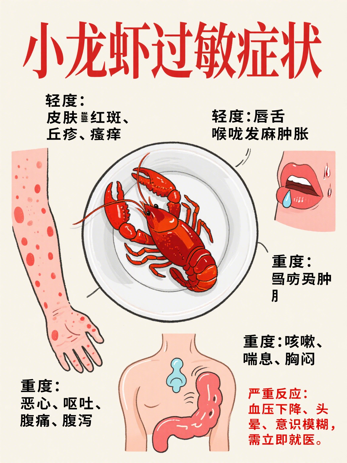 吃小龙虾过敏的症状多样,不同人反应轻重不一哦